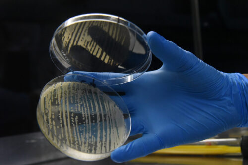 Foto de um mão com luva segurando uma placa de Petri